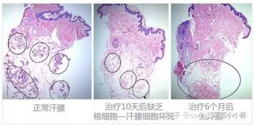 腋窝出汗的明星图片,揭秘腋窝出汗的瞬间魅力